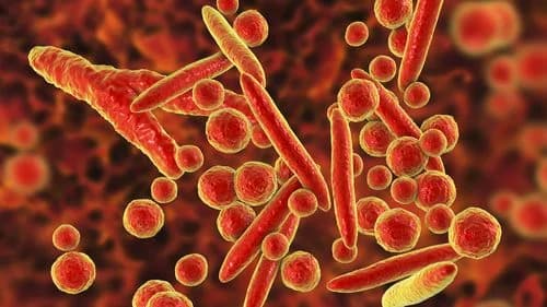 Pneumonia cases increase in NSW children