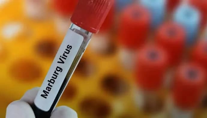 Rwanda: All Patients Recovered from Marburg Virus